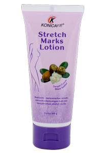 KONICARE STRETCH MARKS LOTION